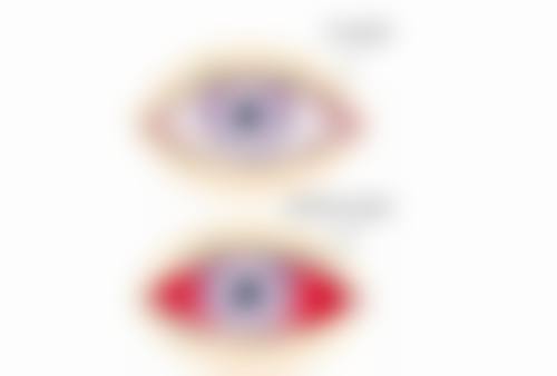 特色科室与项目:精细聚焦近视防控与眼病治疗
