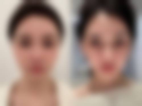 昆明莱森医疗美容诊所治疗反馈与口碑评价。