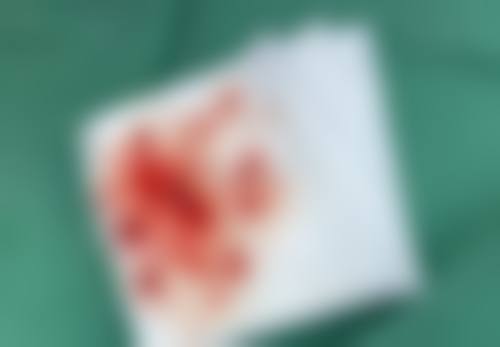 平顶山曾德渊整形医院擅长项目。