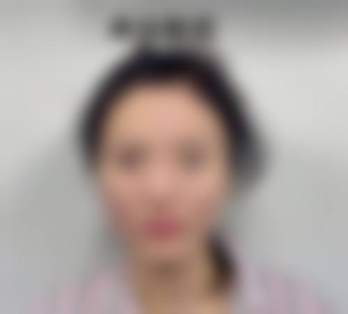 设备环境介绍:精良仪器提升治疗体验