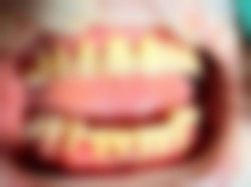 患者真实评价 沈园园医生口碑反馈