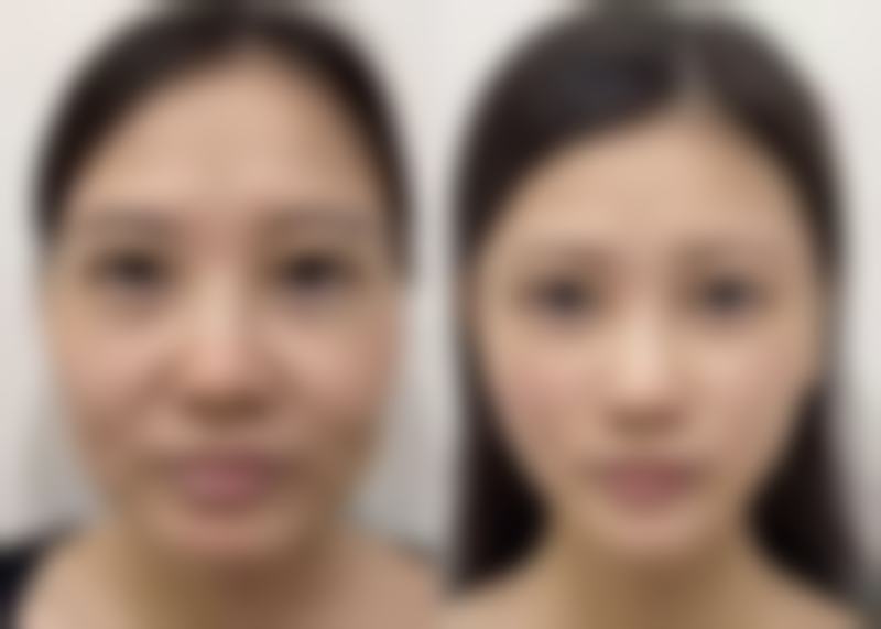 诊疗特色总结:为什么选择罗安丽医生进行个性化方案设计?