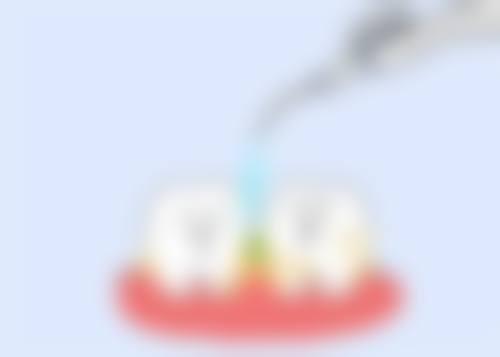 临床实例分享