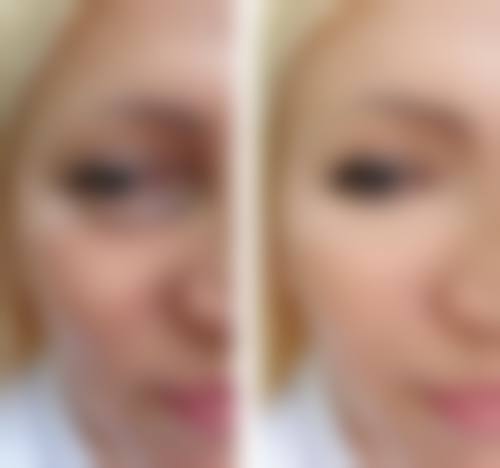 佛山东王荟医疗美容整形预约挂号方式。