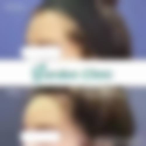 结尾预约号召 林湘梅 皮肤管理