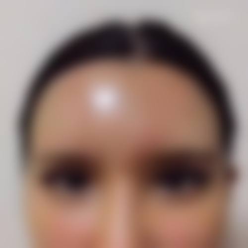 患者真实评价 林湘梅 美体塑形