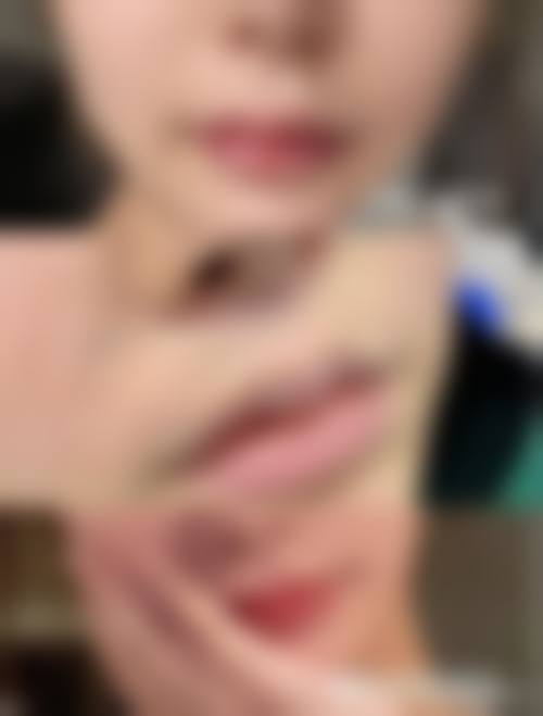 临床实例分享:李少锋医生临床实例分享