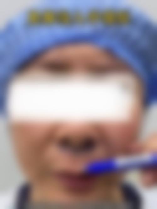 医生资质介绍:杭州雪然慕兮医疗美容诊所李少锋医生