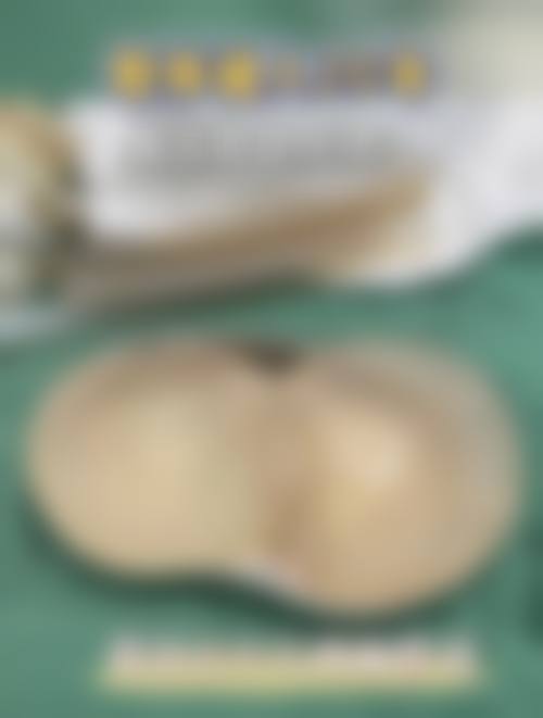 临床实例分享