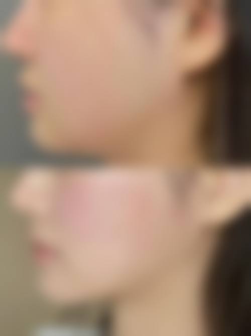 谷城县星璨小妖整形医院医生团队经验稳定。