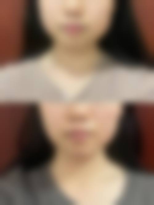 谷城县星璨小妖整形医院预约挂号方式。