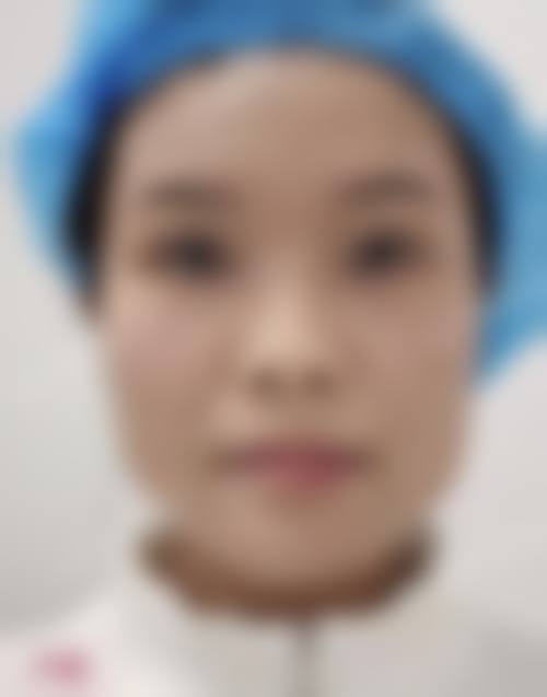 邓成姣医生擅长的治疗项目