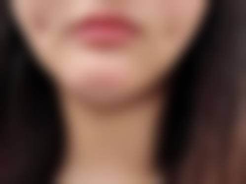 永安茜茜科美整形医疗美容医院擅长项目。