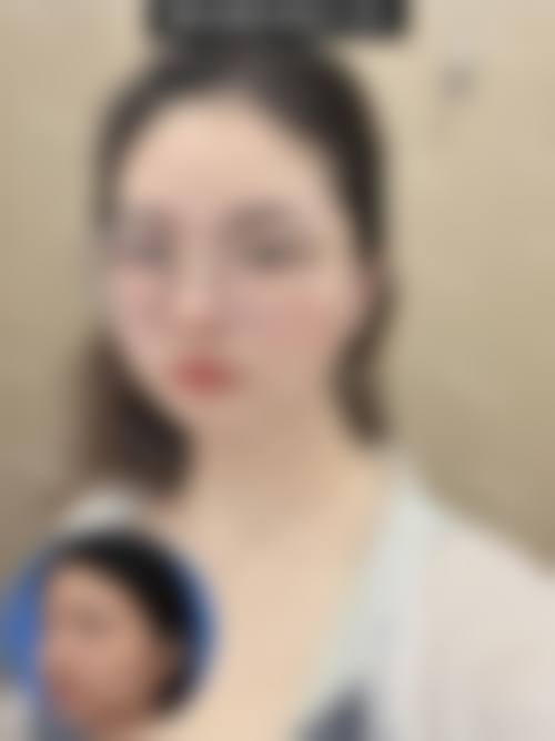 谷城县星璨小妖整形医院擅长项目。