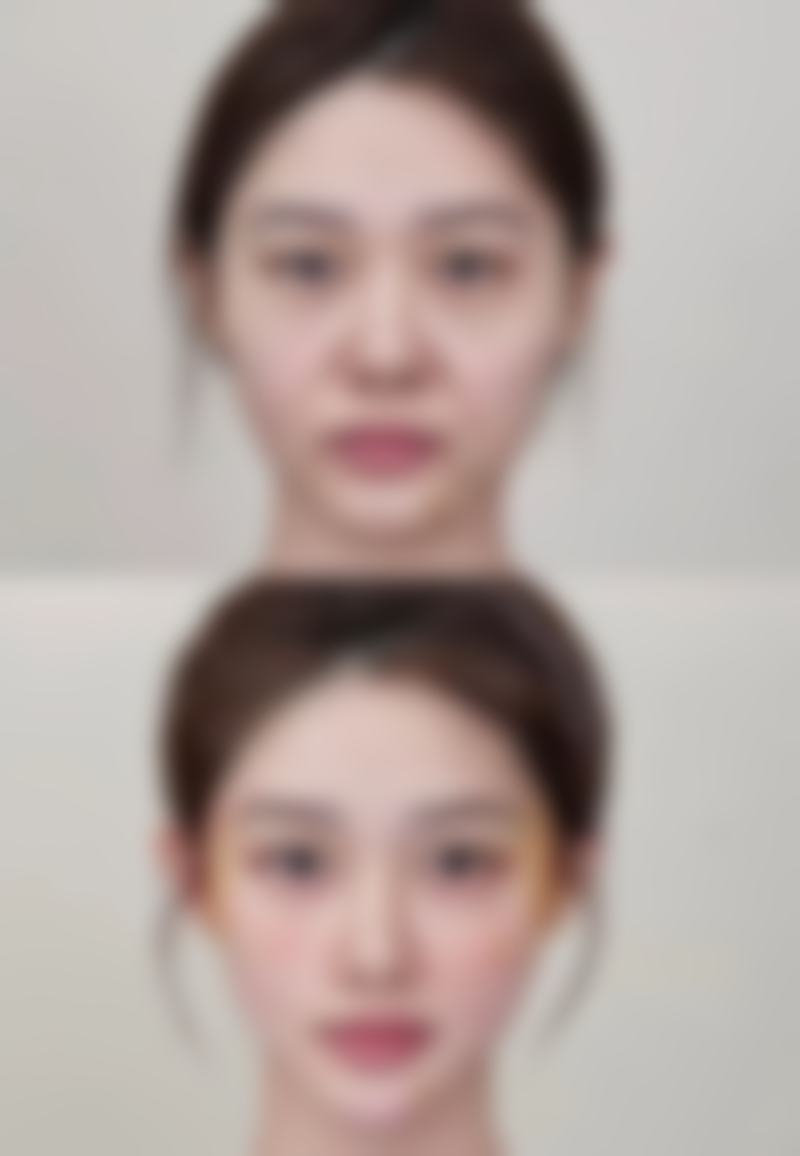 擅长项目详解:李少锋医生擅长项目详解