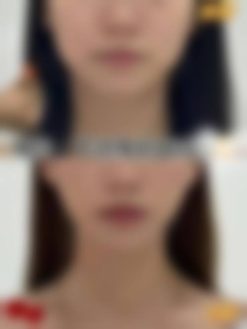 河北衡水惟美整形医疗美容预约挂号方式。