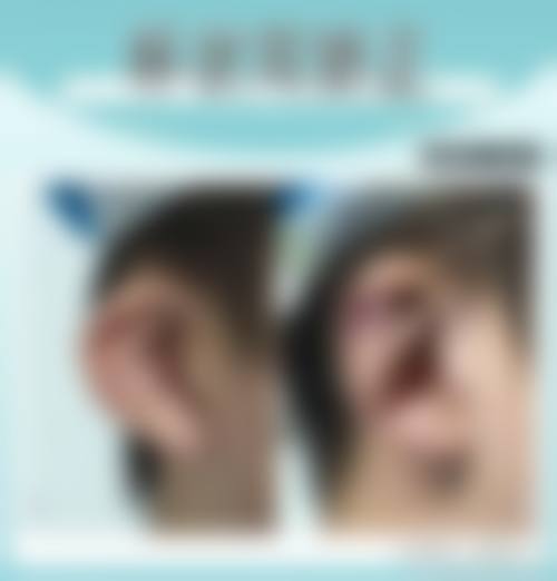 预约优惠活动