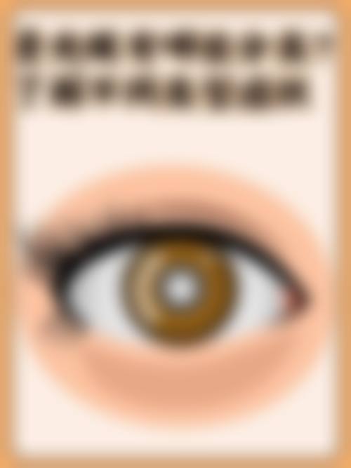 邯郸明仁医院眼科擅长项目。