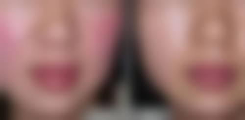 河北衡水惟美整形医疗美容医生团队经验稳定。