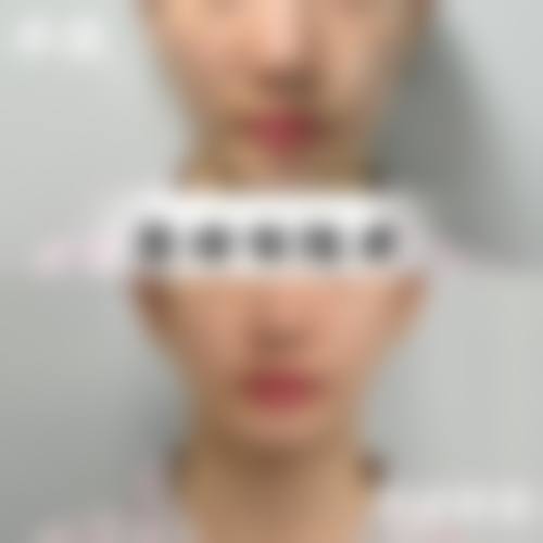 南昌皓颜整形医院项目优势在哪?