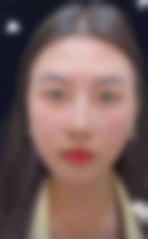 杭州星秘惠悦美整形医院2026年价格收费表: