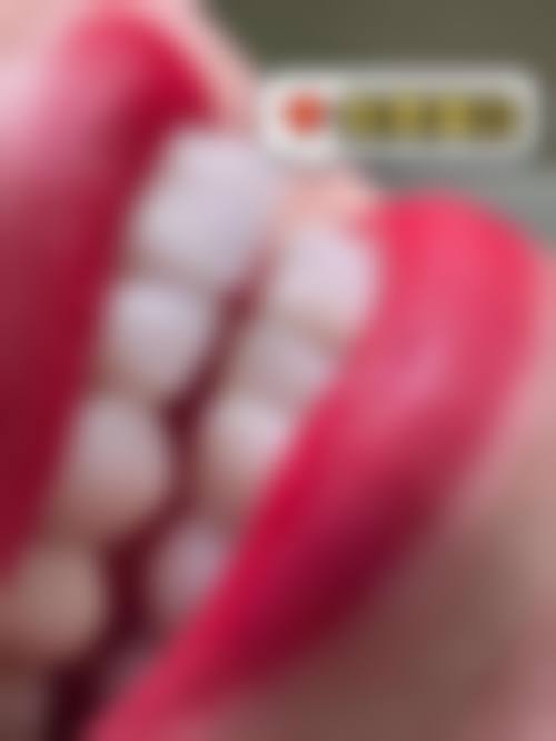 浙江余姚圣亚口腔治疗反馈与口碑评价。