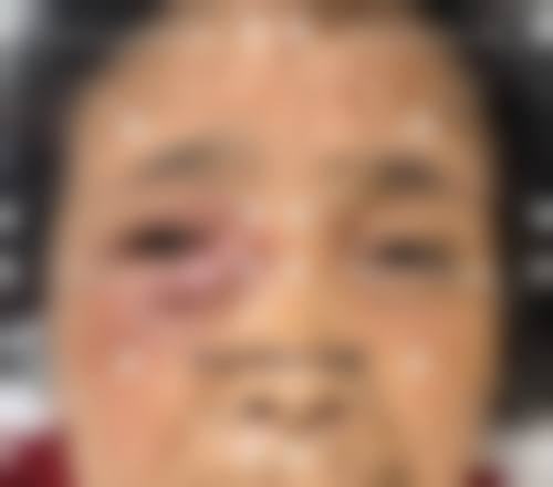 山东大学齐鲁医院德州医院眼科治疗反馈与口碑评价。