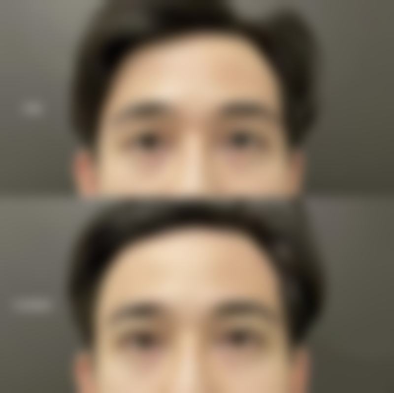 南昌皓颜整形医院擅长项目。