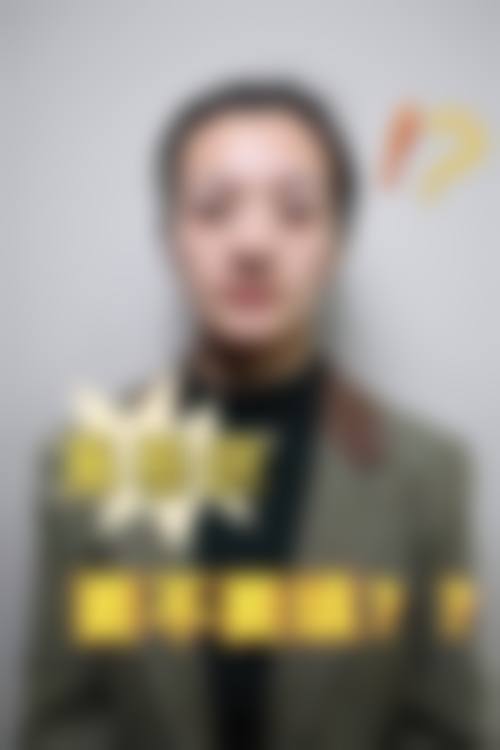 长沙新生毛发种植研究院治疗反馈与口碑评价。