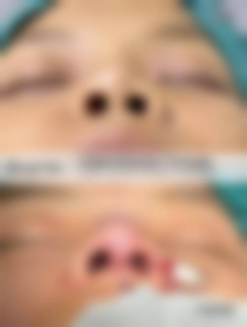 结尾