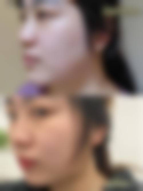 优惠活动详情:以高性价比体验医美