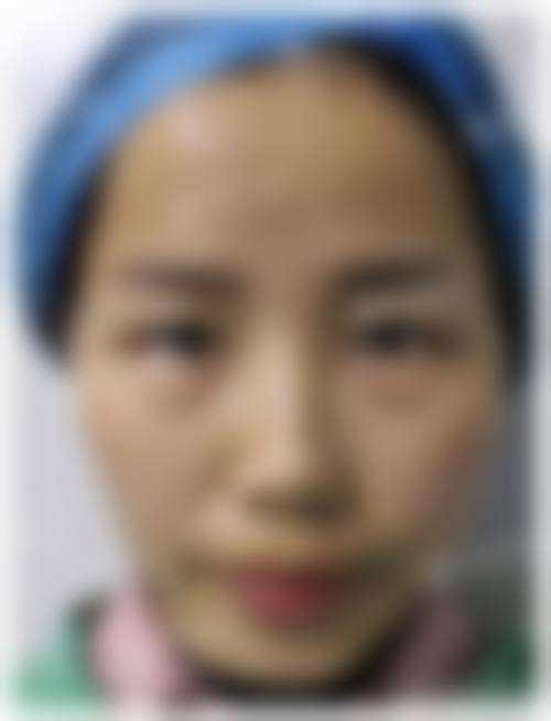 重庆万州区第四人民医院医疗美容科地理位置便于到院。