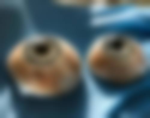 宁波市第一医院眼科预约挂号方式。
