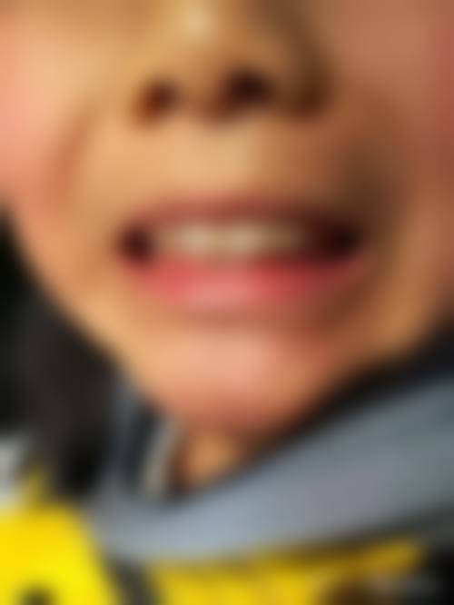 擅长项目详解