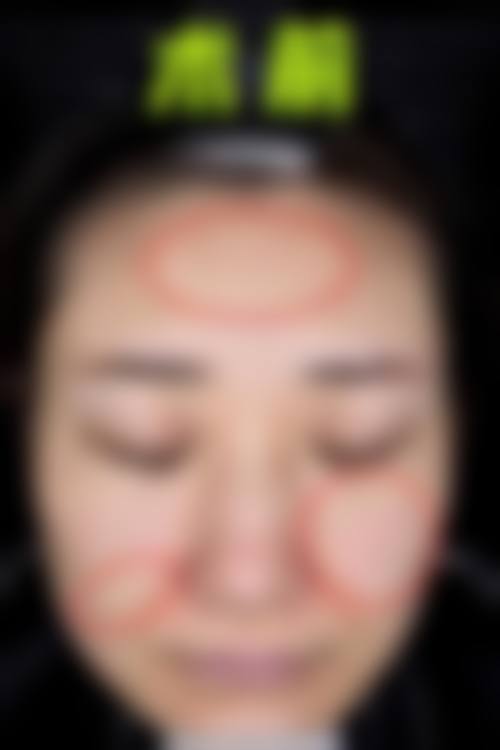 患者真实评价:张会生医生的口碑反馈