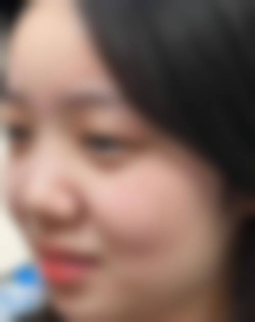 特色技术与项目:定制您的专属植发方案