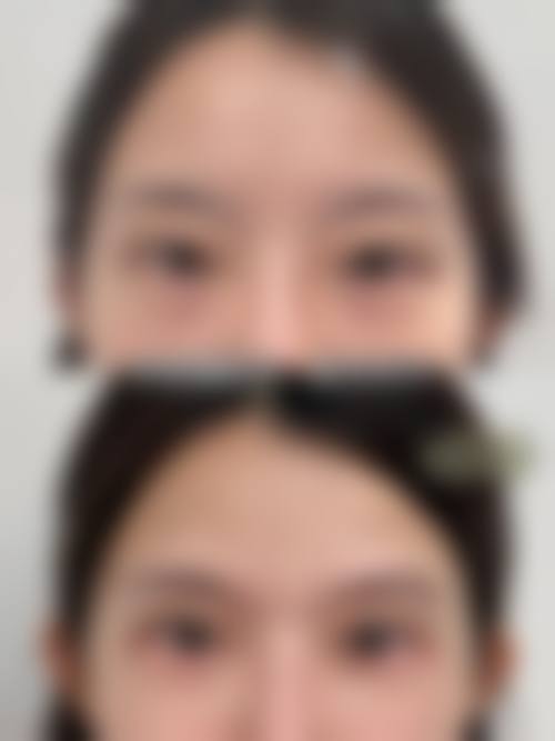 结尾预约号召:立即行动,预约张会生医生