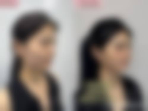 深圳悦芙医疗美容诊所项目优势明显。