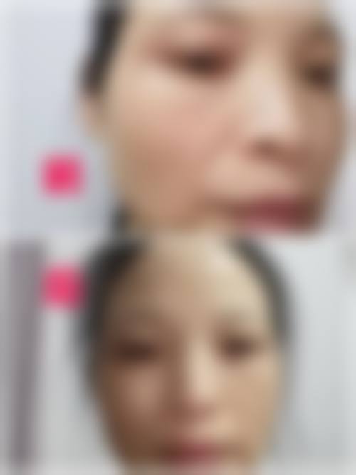 徐州文龙整形医疗美容诊所治疗反馈与口碑评价。