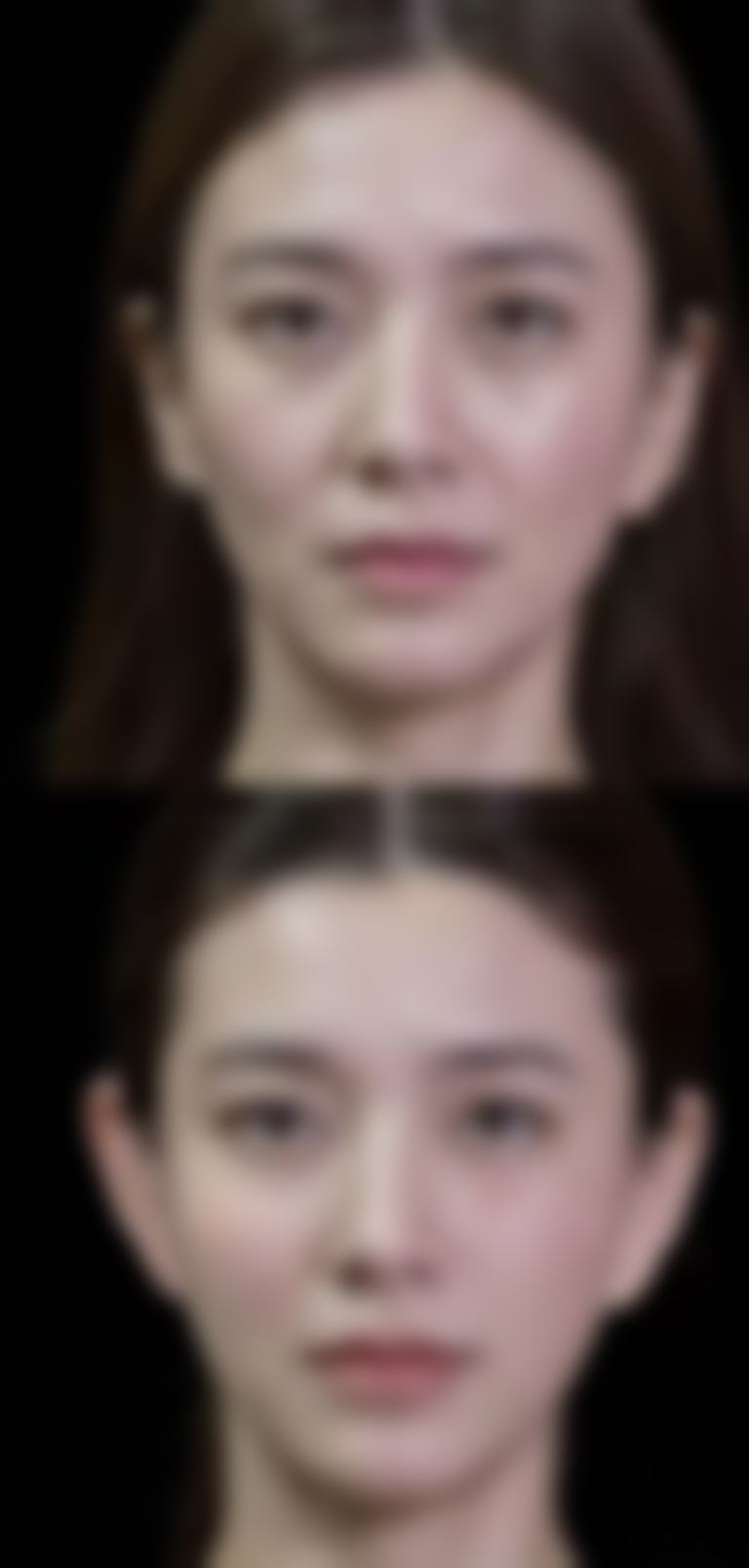 昆明丽都医疗美容治疗反馈与口碑评价。