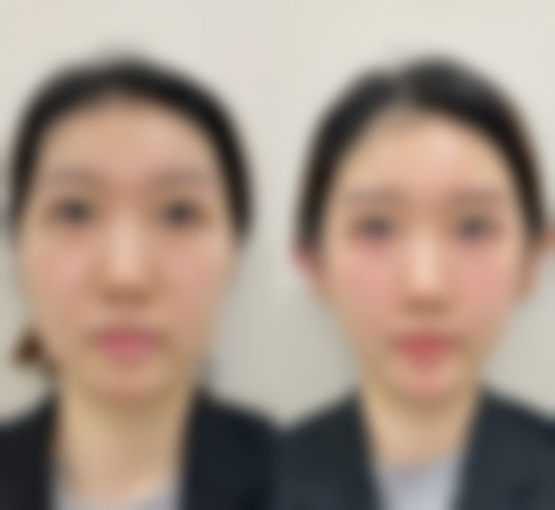 潘光磊医生的技术实力