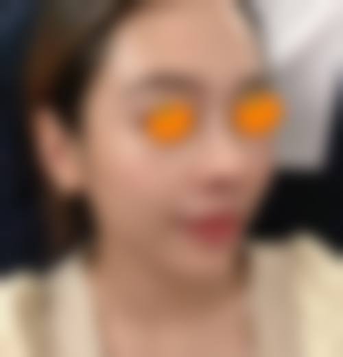 擅长项目详解