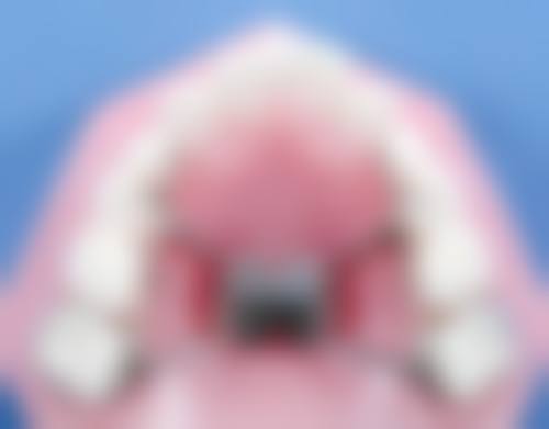 优惠活动详情