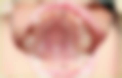 廊坊三河永佳佳丽口腔(永康口腔)治疗反馈与口碑评价。