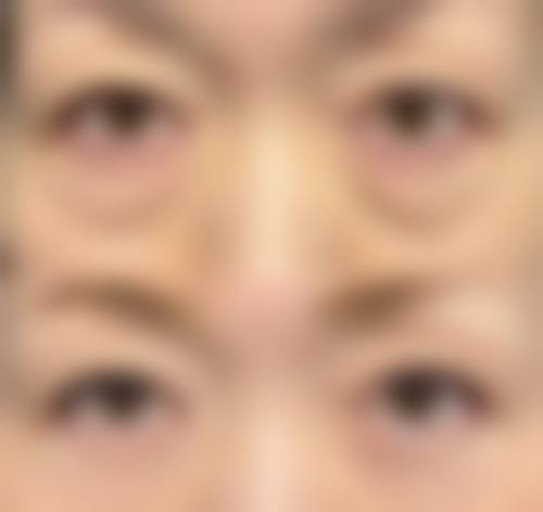 杭州迪美整形医院预约挂号方式。
