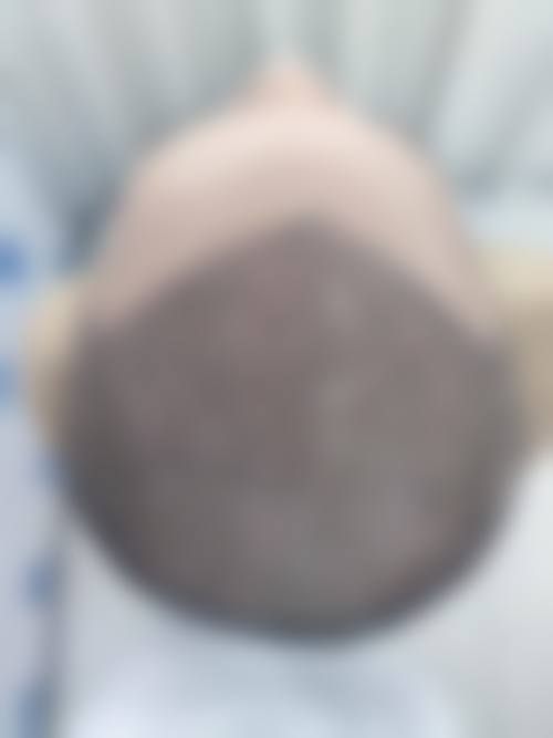 热门项目价格参考表(市场参考价)