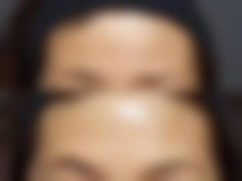 上饶市太洋花整形美容医生团队经验稳定。