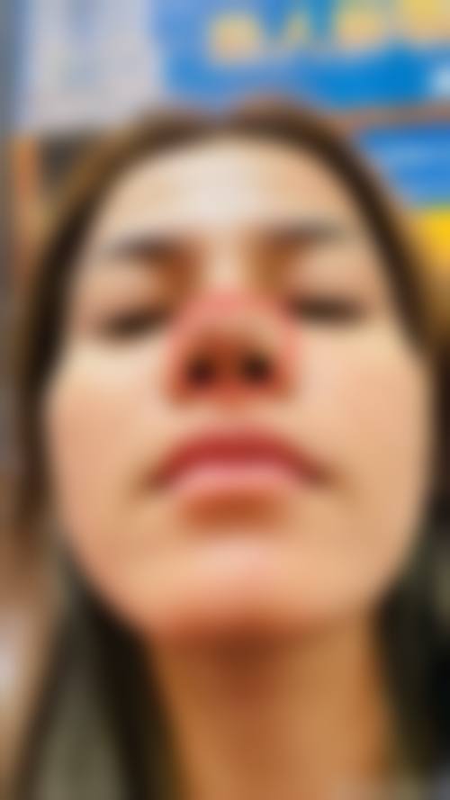 上饶市太洋花整形美容治疗反馈与口碑评价。