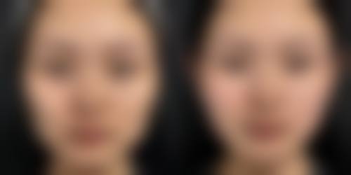 杭州丽星整形医院金荣敏医生的口碑如何?听听她们怎么说