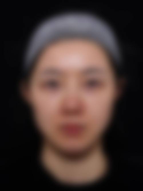 天津韩艺整形医疗美容诊所的口碑好评与真实反馈